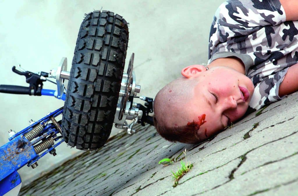persoon gevallen met fiets hoofdletsel