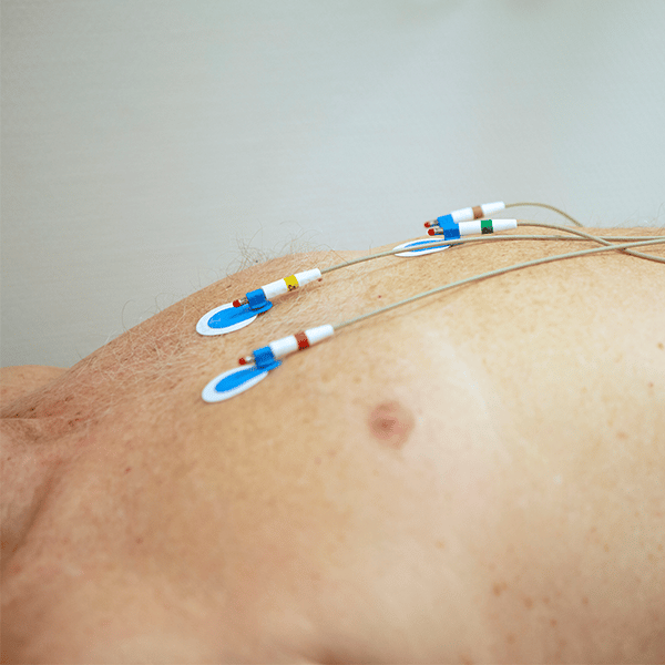 Blote borstkas met elektroden erop geplakt.