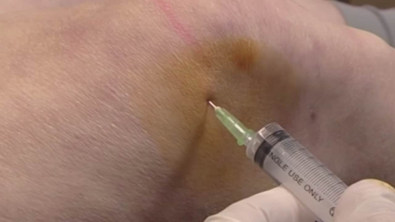 Instructiefilm Knie intraarticulaire injectie