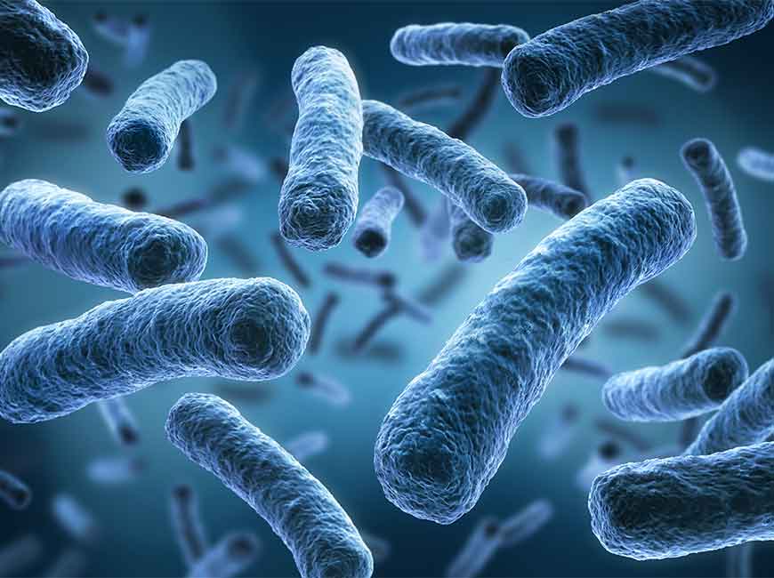Legionella Pneumophila