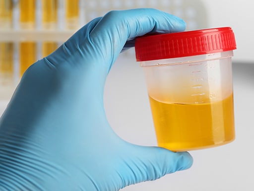 onderzoek naar potje urine