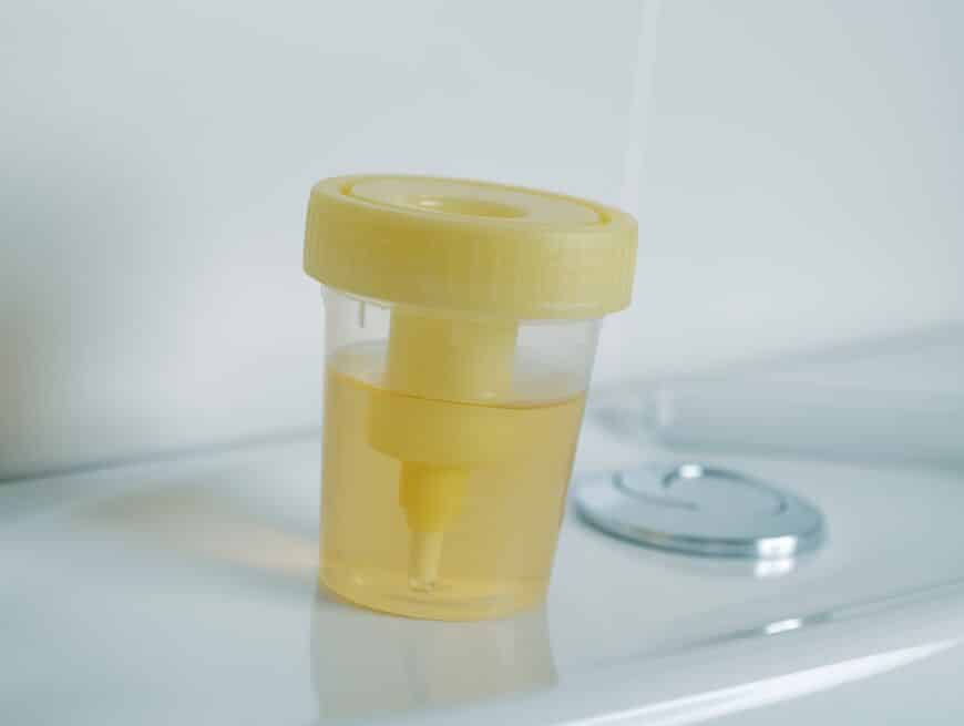 Beperkt herzien: NHG-Standaard Urineweginfectie