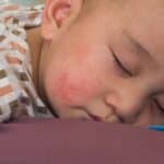 Kind met koorts liggend op de bank